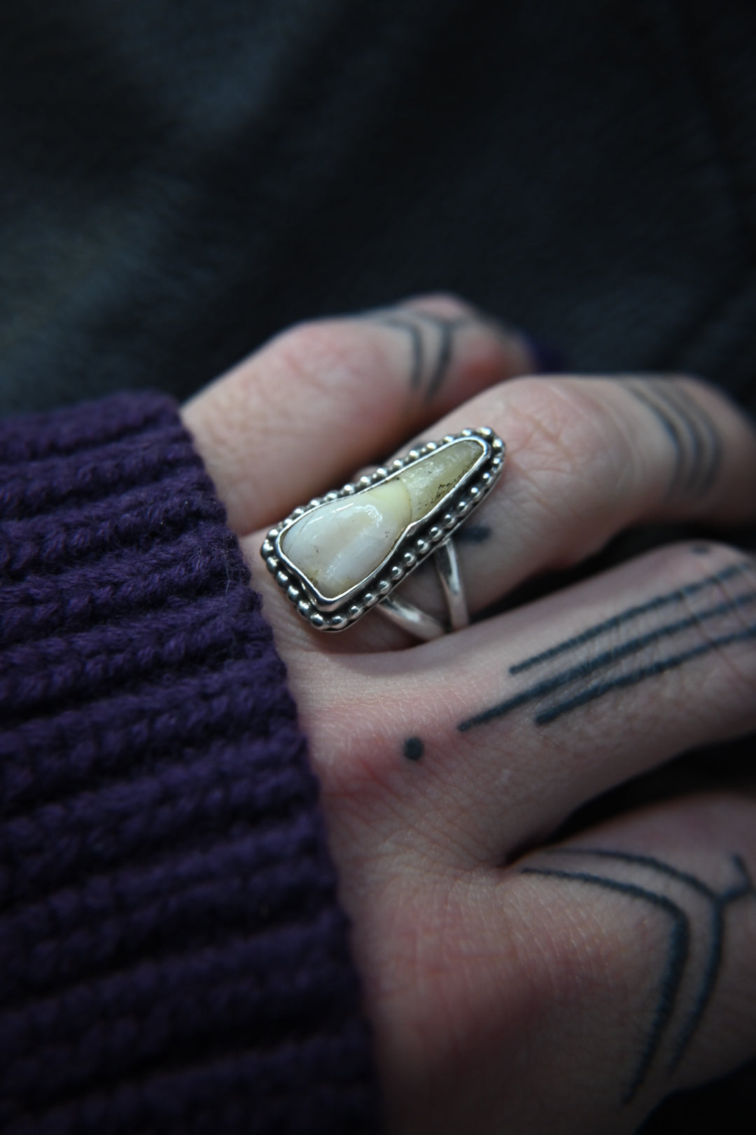 Tooth Ring