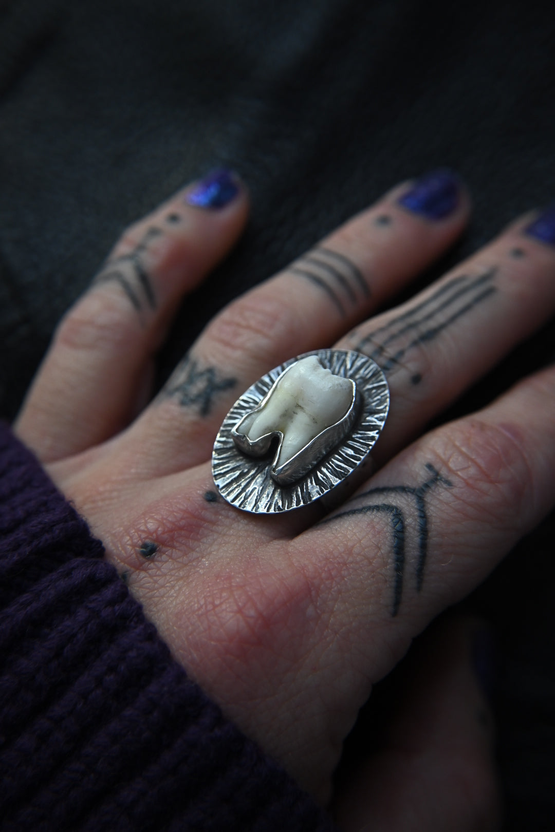 Tooth Ring