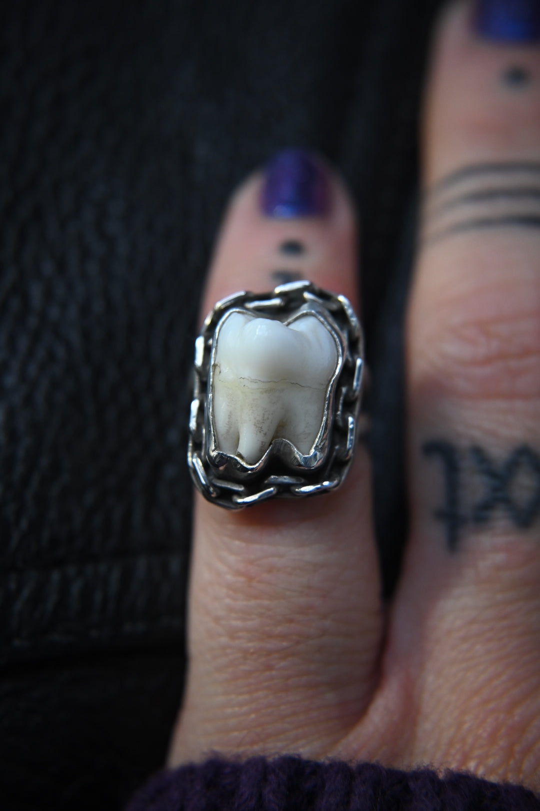 Tooth Ring