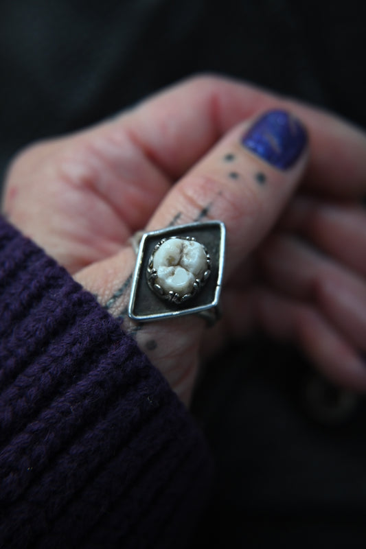 Tooth Ring
