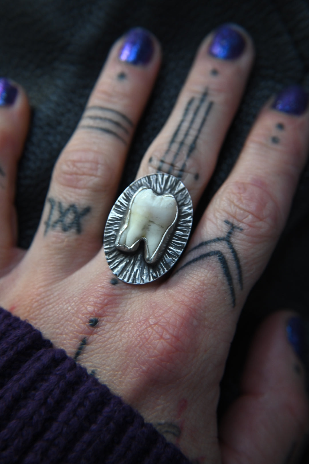 Tooth Ring