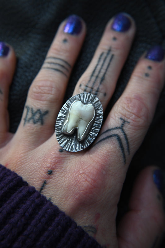 Tooth Ring