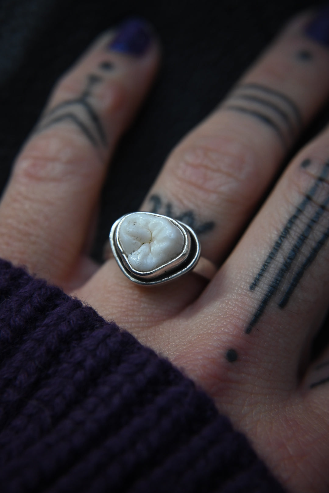 Tooth Ring